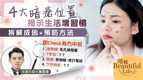 人中生暗瘡面相|暗瘡位置：揭示面相與身體健康的密切關係